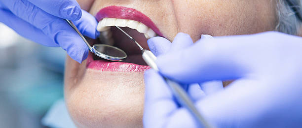 Best Emergency Dentist for Lost Fillings or Crowns in Primera, TX